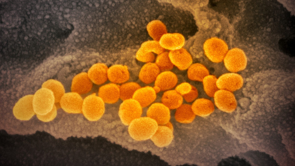 Коронавирус, вызывающий глобальную пандемию (оранжевый цвет), появляется из клетки (серый цвет). Новое исследование предполагает, что вирус может легко расти в носу и горле людей и может передаваться до того, как люди узнают, что они больны. NATIONAL INSTITUTE OF ALLERGY AND INFECTIOUS DISEASES-ROCKY MOUNTAIN LABORATORIES/NIH.