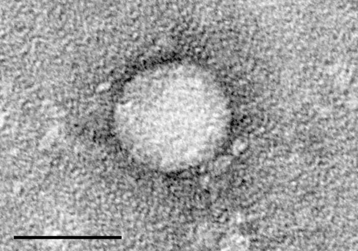 Электронная микрофотография вируса гепатита C, выделенного из клеточной культуры. Длинна масштабной метки 50 нм.