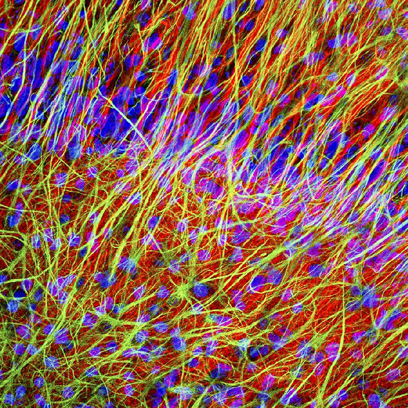 Нейронами (показанные здесь на флуоресцентной микрофотографии) можно манипулировать с помощью световых импульсов. Авторы: Dr. Chris Henstridge / Science Photo Library